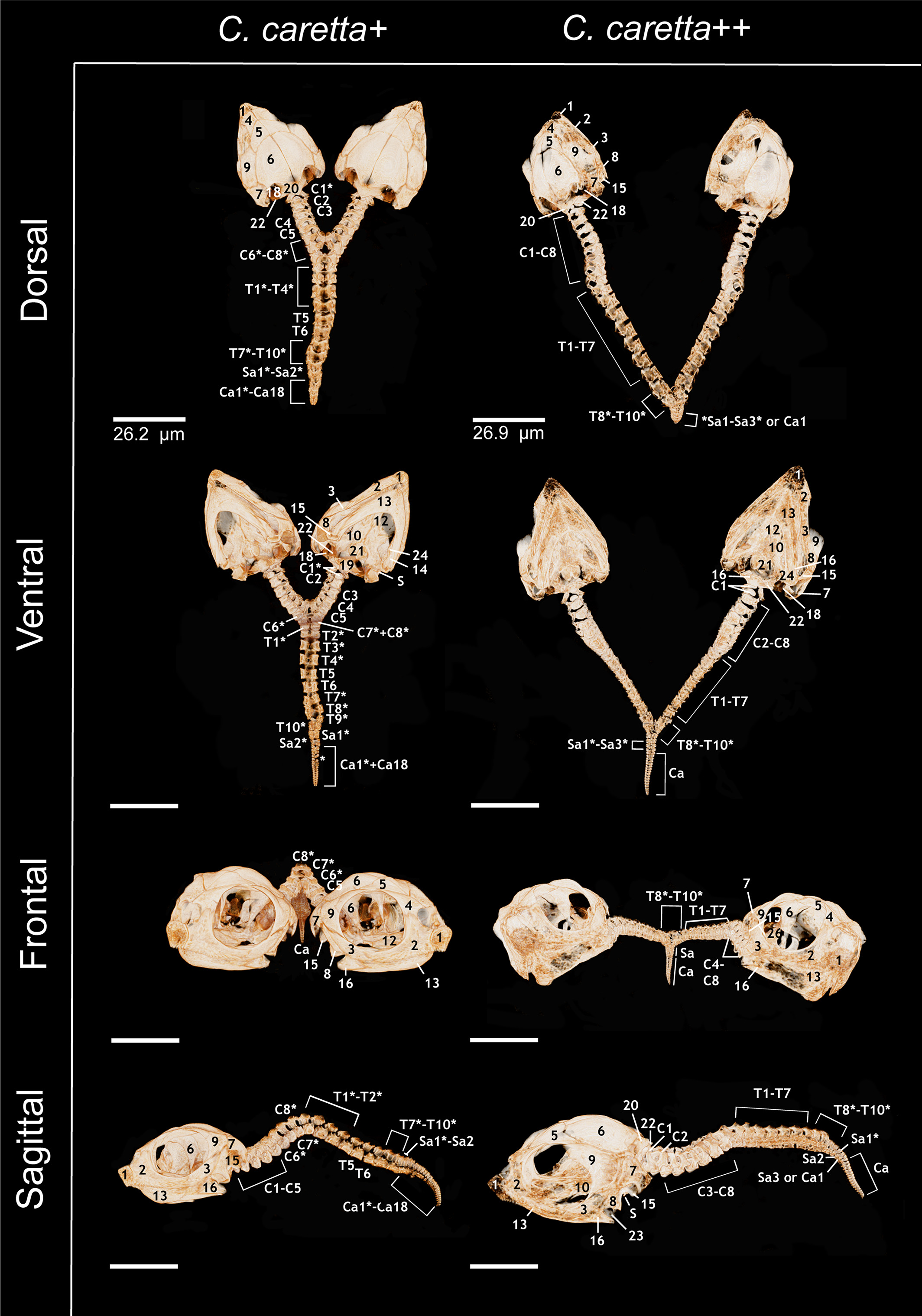 3D Models of the skulls and vertebrae of bicephalic loggerhead hatchlings